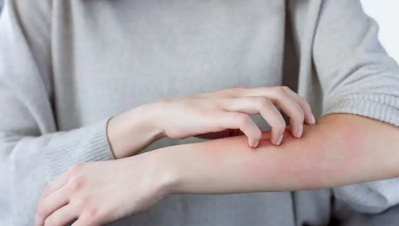 Cilt Kanseri Belirtileri: Dermatolog Gözden Kaçan İki İşareti Açıkladı!